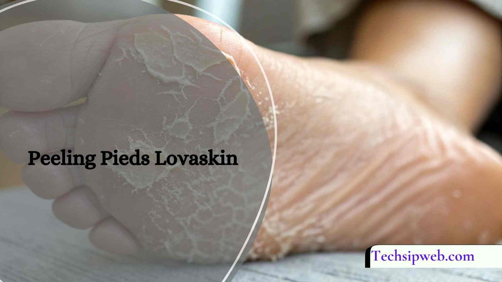 Peeling Pieds Lovaskin